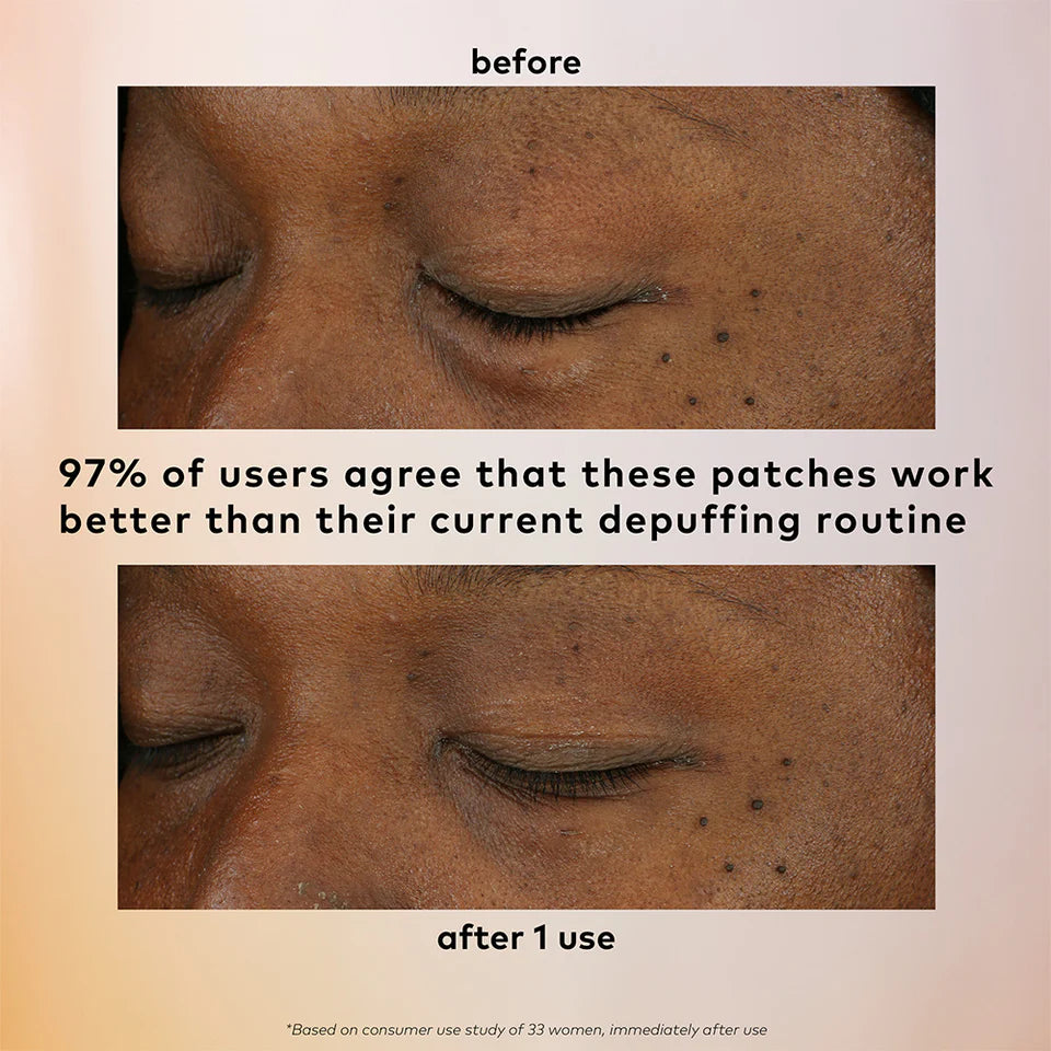 The Good Patch - De-Puff